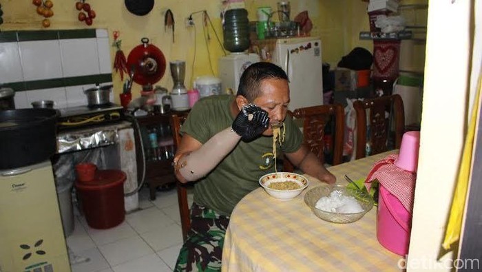 Ledakan Granat yang Menghilangkan Telapak Tangan Serka Siswandi