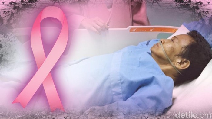Rosida, Penderita Kanker Payudara yang Sempat Telantar di Gerobak Meninggal Dunia