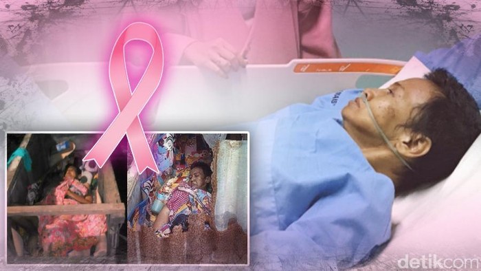 Rosida Ibu Penderita Kanker Payudara yang Terusir Kini Dirawat di RS Dharmais