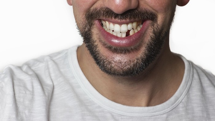 Pertama Kalinya, Ilmuwan Bakal Uji Coba Obat Penumbuh Gigi pada Manusia