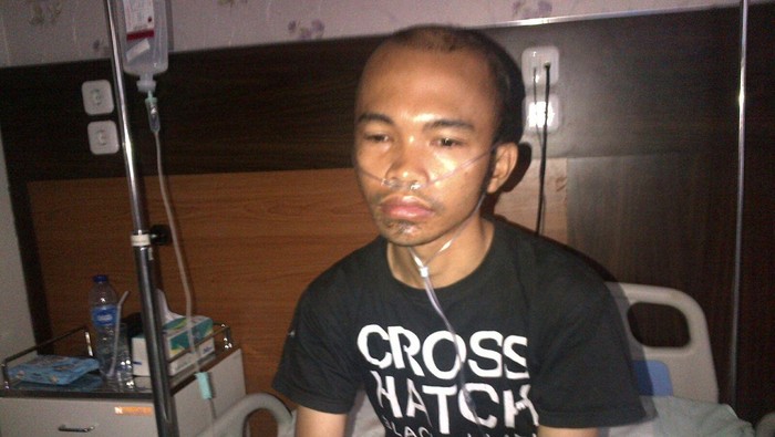 Kondisi Driver Go-Jek yang Diserang Orang Bersenpi di Kemang Membaik
