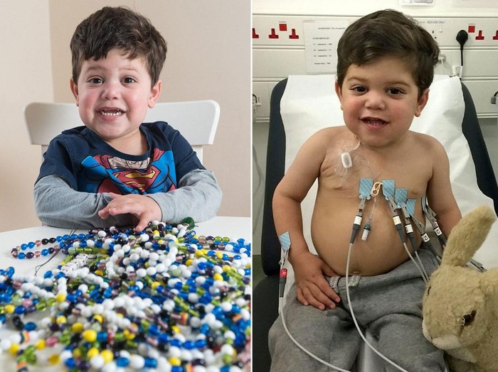 Kisah Oliver yang Harus Jalani Ribuan Prosedur untuk Bisa Bertahan Hidup