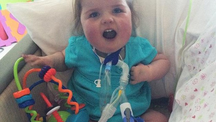 Kena Sindrom Tak Biasa, Zoey Sempat Gagal Jantung 7 Kali dan Stroke 3 Kali