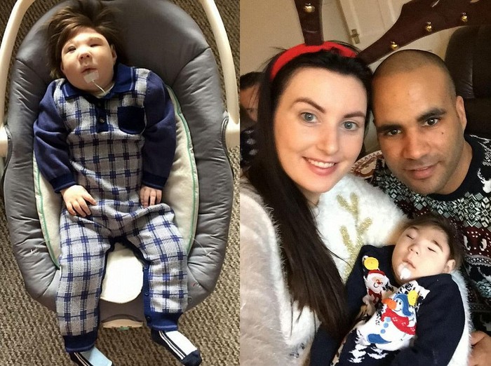 Bayi dengan Kondisi Otak Tak Sempurna Ini Rayakan Ulang Tahun Pertamanya