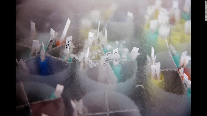 Menabung Sperma di Usia Muda, Mendesak atau Tidak?