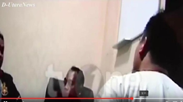 Korban Baru Saipul Jamil Rampungkan Visum