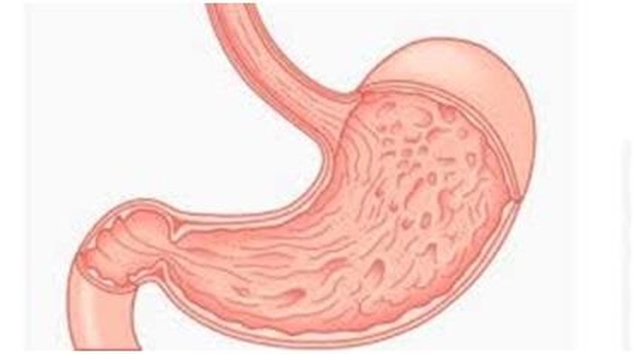 Hasil gambar untuk Lambung