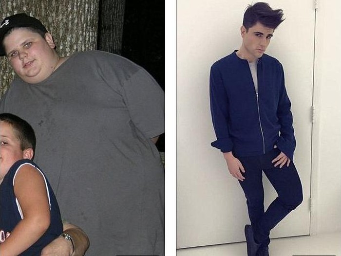 Sering Di-bully karena Bertubuh Gemuk, Pria Ini Turunkan Bobot 75 Kg!