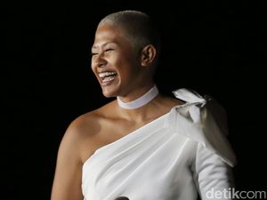 Botak, Dira Sugandi Tetap Kece!