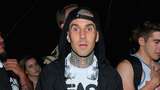 Dilarikan ke RS, Travis Barker Jelaskan Sakit Pankreatitis yang Ancam Nyawanya