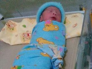 Lahirnya Albi, Bukti Gerhana Matahari Bikin Bayi Berwajah Hitam Hanya Mitos