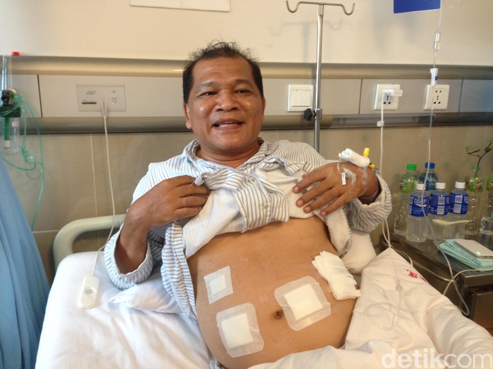 Cerita Pasien Diabetes Asal Indonesia Jalani Bypass Lambung di China