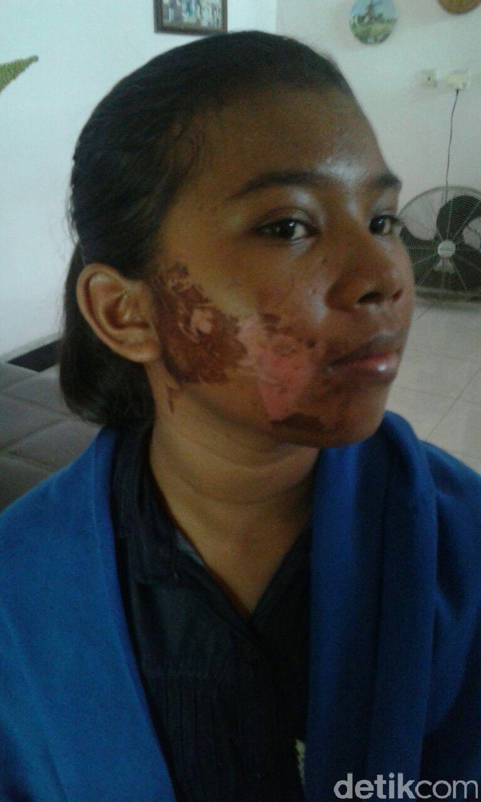 Majikan yang Aniaya PRT di Koja Ditahan