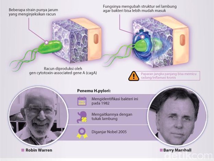 Ilmuwan Peraih Nobel Sebut Tak Semua Bakteri Tukak Lambung Menghasilkan Racun