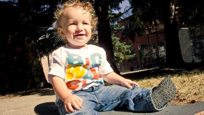 Anak Ini Sakit Meningitis, Tapi Hanya Diberi Pengobatan Rumahan