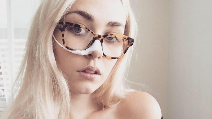 Punya Kondisi Langka, Claudia Alergi Berdiri Tegap