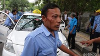 Darah mengalir ke pipi, wajahnya juga lebam.