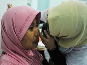 1.000 Pasien Tak Mampu Jalani Operasi Katarak Gratis