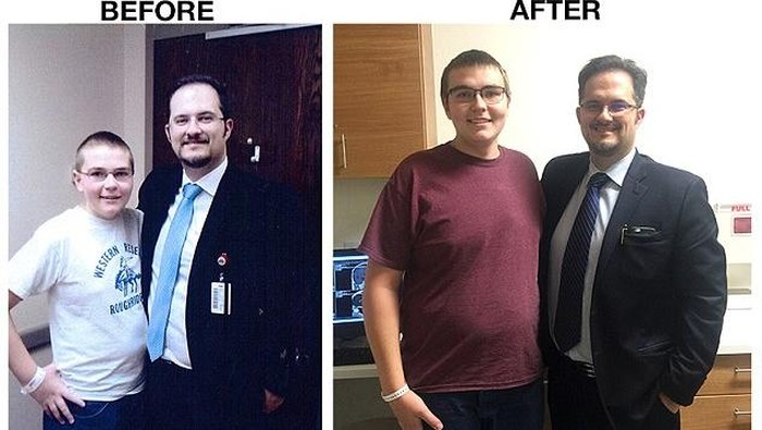 Karena Ada Tumor Otak, Jacob Jadi Tak Alami Pubertas di Usia 17 Tahun