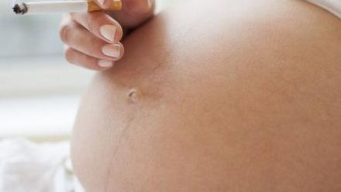 Kurangi Jumlah Ibu Hamil Perokok, RS di Prancis Tawarkan Voucher