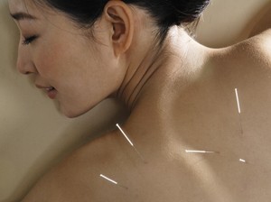 Kecelakaan Akupuntur, Paru-paru Wanita Ini Kolaps Tertusuk Jarum
