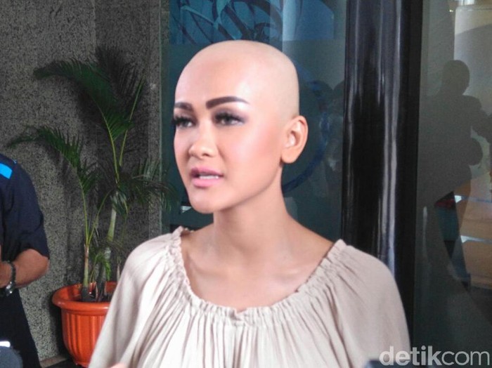 Jupe Gundul Bukan karena Gaston