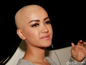 Ibunda Nangis Lihat Julia Perez Kini Gundul
