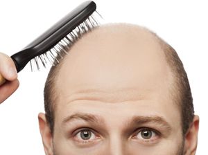 Apakah Stres Bisa Memengaruhi Kesehatan Rambut? Simak Penjelasan Psikiater