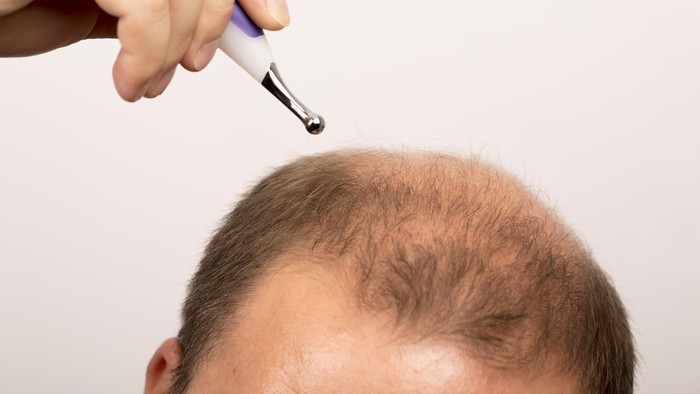 Foto: thinkstock Foto: thinkstock