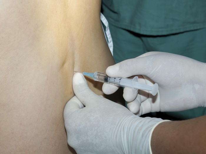 Selain Hentikan Injeksi Bupivacain, Kemenkes Juga Bentuk Tim Investigasi