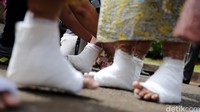 Kaki diperban sebelum dibeton.