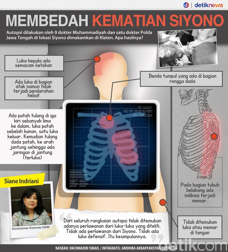 Anggota DPR: Kasus Siyono Momentum Evaluasi Kinerja Pemberantasan Terorisme Anggota DPR: Kasus Siyono Momentum Evaluasi Kinerja Pemberantasan Terorisme