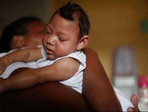 Banyak Rumor Soal Zika, Pakar: Mirip Seperti Gejala Epidemi