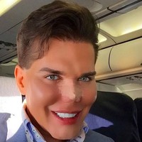 Sebelum kini ganti kelamin sebagai wanita, Jessica saat menjadi Rodrigo telah berulang kali operasi plastik. Untuk bagian hidung saja, dia sudah melakukannya sembilan kali. Dokter pun mengatakan jika dioperasi kembali, bukan tidak mungkin hidungnya akan copot. Tapi dia tidak peduli dan tetap melakukannya. Foto: Instagram