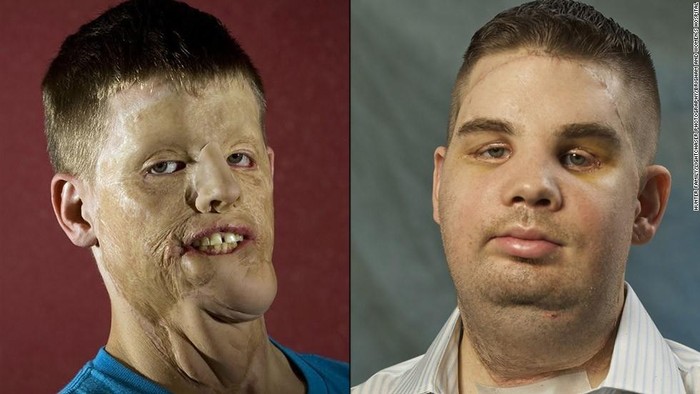 Foto: CNN Foto: CNN
