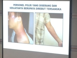 Kapolri Tunjukkan Foto Luka-luka Anggota Densus 88 yang Kawal Siyono