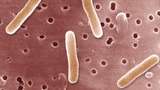 Gejala Infeksi Salmonella yang Mewabah di AS di Tengah Corona