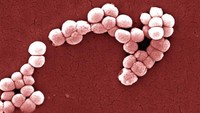 Micrococcus Luteus. Bakteri ini sejatinya adalah flora normal yang ada di kulit manusia dan bertanggung jawab terhadap munculnya bau pada kaki dan ketiak ketika berkeringat. Namun pada pengidap HIV atau pasien kemoterapi yang daya tahan tubuhnya lemah, bakteri ini bisa menyebabkan sepsis. (Foto: BSIP/UIG Via Getty Images)