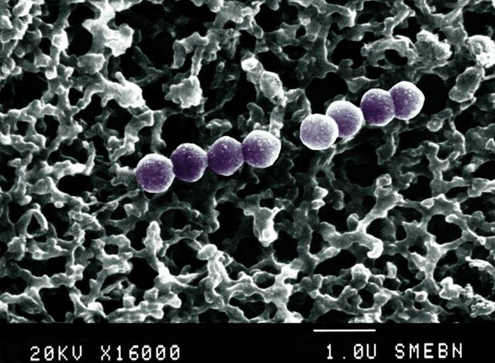 Bakteri Penyakit - Detik.com