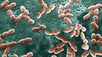 Pseudomonas Aeruginosa. Bakteri ini merupakan penyebab utama infeksi nosokomial (infeksi yang ditularkan dari rumah sakit). Bakteri ini dapat menyebabkan diare, infeksi saluran kencing hingga gangguan pernapasan. (Foto: BSIP/UIG Via Getty Images)