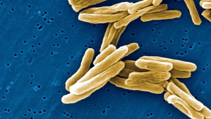 Under a high magnification of 15549x, this scanning electron micrograph, SEM, depicted some of the ultra structural details seen in the cell wall configuration of a number of Gram-positive Mycobacterium tuberculosis bacteria. As an obligate aerobic organi