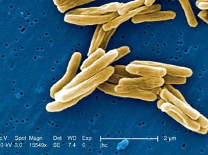 Begini Ciri-ciri Pasien TB Sembuh Total