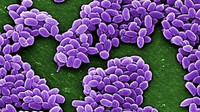 Bacillus Anthracis. Bakteri ini adalah penyebab penyakit antrax, salah satu penyakit infeksi paling mematikan di dunia. Biasa hidup di daging sapi dan kambing, bakteri ini dapat menyerang paru-paru, sistem pencernaan dan kulit. (Foto: Media for Medical/Getty Images)