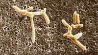 Listeria. Bakteri ini biasa hidup di tanaman dan buah yang tidak dijaga dengan baik. Ketika menginfeksi manusia, bakteri ini menyebabkan penyakit listeriosis. (Foto: BSIP/UIG Via Getty Images)