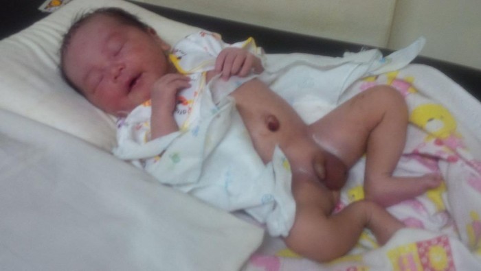 Warga Cilandak Timur Temukan Bayi Laki-laki Tergeletak di Pos RW