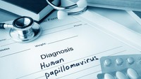 Kanker lidah bisa dipicu oleh infeksi virus. Human Papilloma Virus (HPV) bisa menyebabkan berbagai jenis kanker di rongga mulut. Virus yang sama juga menyebabkan kanker serviks atau mulut rahim. (Foto: Thinkstock)