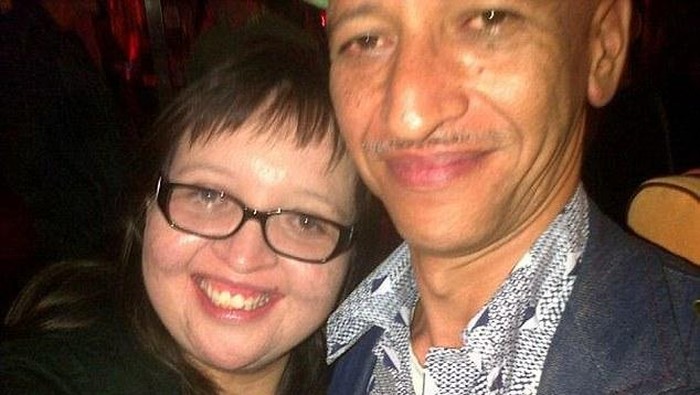 Idap Penyakit Langka, Wanita Ini Pingsan Tiap Dengar Suara Keras