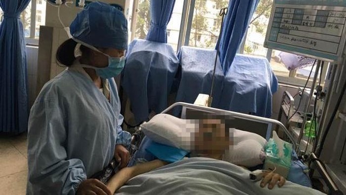 10 Tahun Ada Tumor di Perut, Pria Ini Terlihat Seperti Hamil