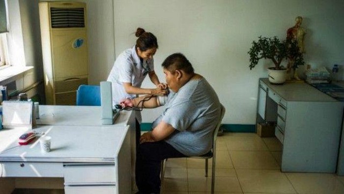 Tak Hanya yang Kurus Saja, Orang Gemuk Juga Bisa Dibilang Malnutrisi