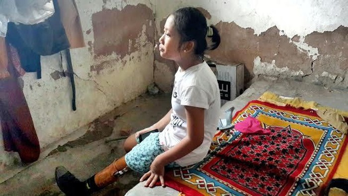 Kisah Ayu Remaja dengan Puisi Jangan Panggil Aku Pincang